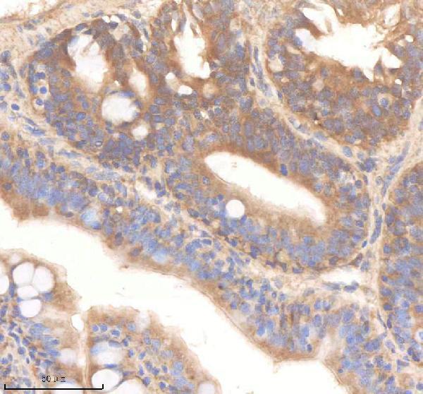 aza0a8m6yy70 pard3aa primary antibodies ihc testing 4