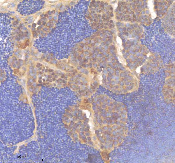 aza0a8m6yy70 pard3aa primary antibodies ihc testing 5