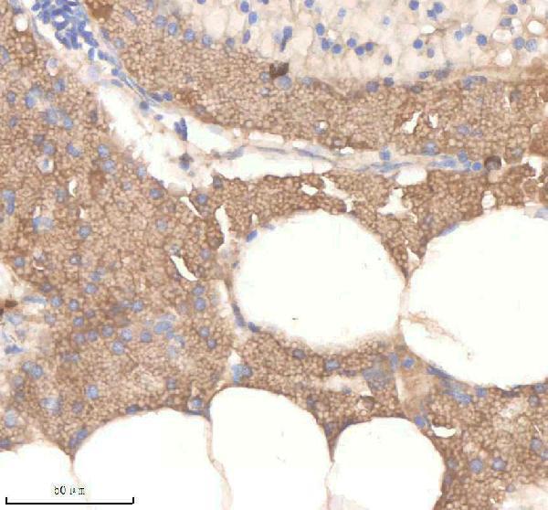 aza0a8m6yy70 pard3aa primary antibodies ihc testing 6