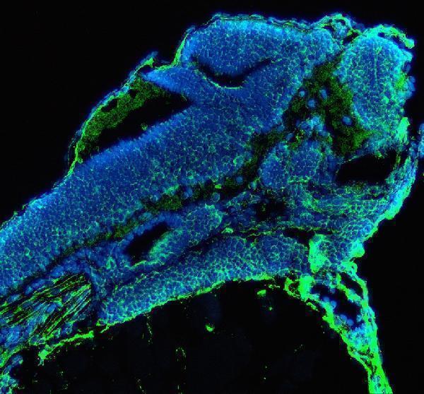 aza0a8m6yz52 acaca primary antibodies if testing 1