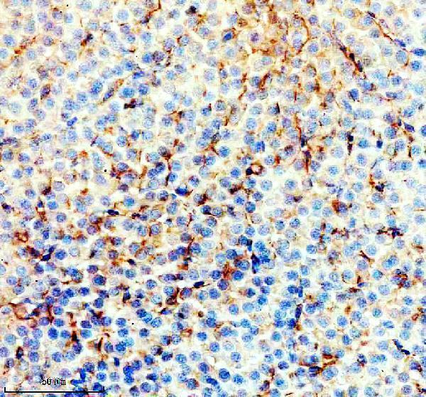 IHC analysis of ACC1/ACACA using anti-ACC1/ACACA antibody (AZA0A8M6YZ52)