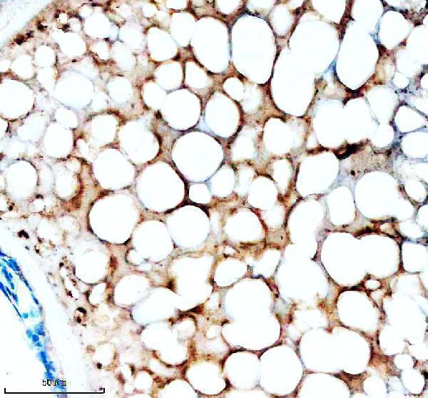 IHC analysis of ACC1/ACACA using anti-ACC1/ACACA antibody (AZA0A8M6YZ52)