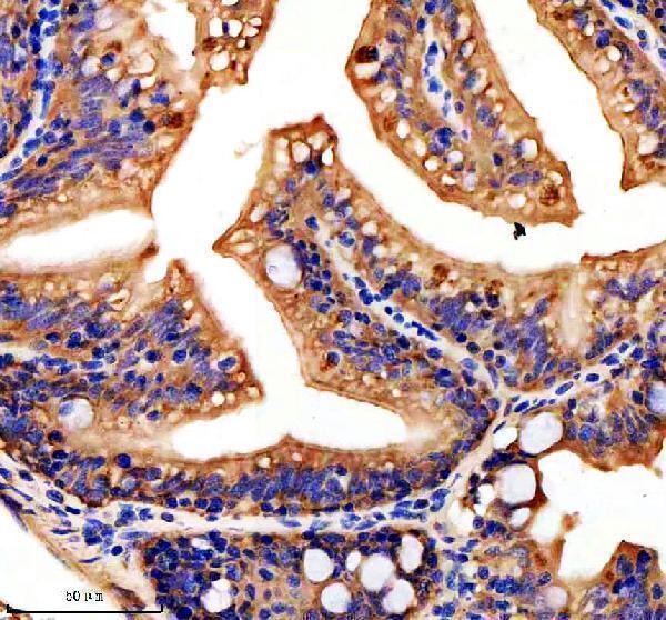  IHC analysis of HOOK3 using anti-HOOK3 antibody (AZA0A8M6Z0P5)