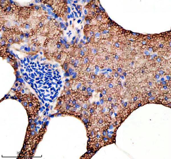  IHC analysis of HOOK3 using anti-HOOK3 antibody (AZA0A8M6Z0P5)