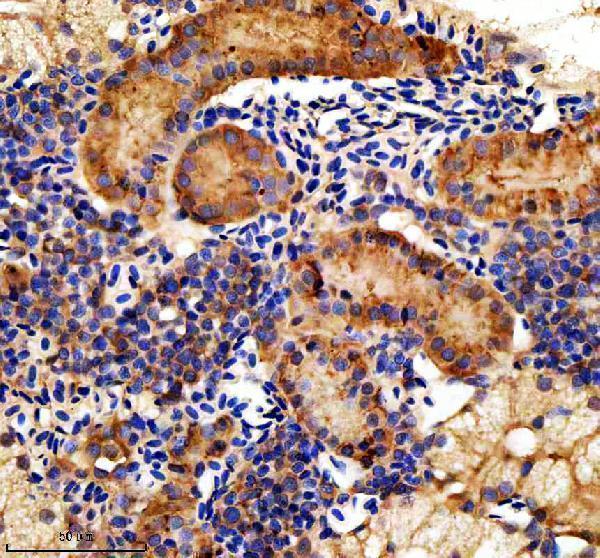aza0a8m6z0p5 hook3 primary antibodies ihc testing 4