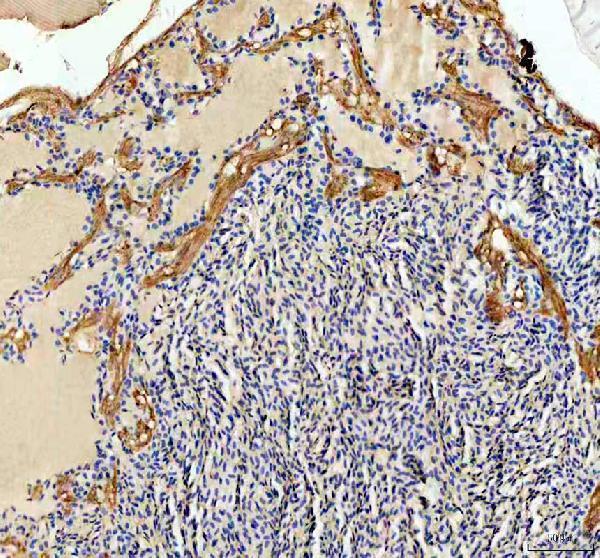 aza0a8m6z2b4 ckba b primary antibodies ihc testing 2