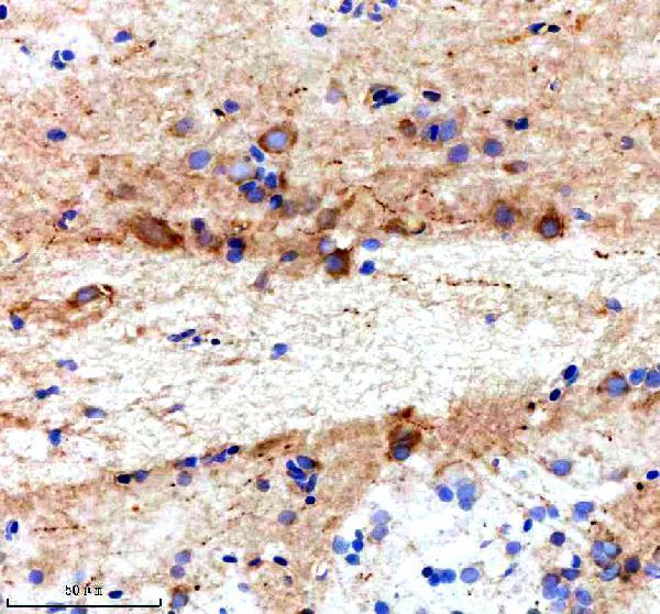 aza0a8m6z8c1 ttc28 primary antibodies ihc testing 1