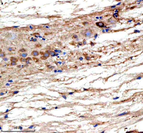 aza0a8m6z8c1 ttc28 primary antibodies ihc testing 2