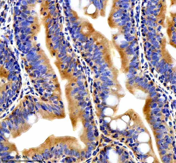 aza0a8m6z8c1 ttc28 primary antibodies ihc testing 3
