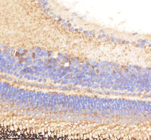 aza0a8m9pe33 pabpc4 primary antibodies ihc testing 1