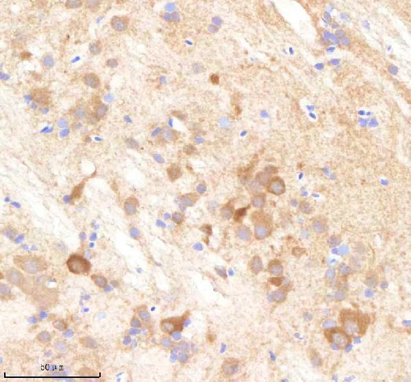aza0a8m9pe33 pabpc4 primary antibodies ihc testing 2