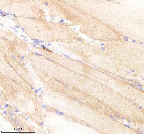 aza0a8m9pe33 pabpc4 primary antibodies ihc testing 3