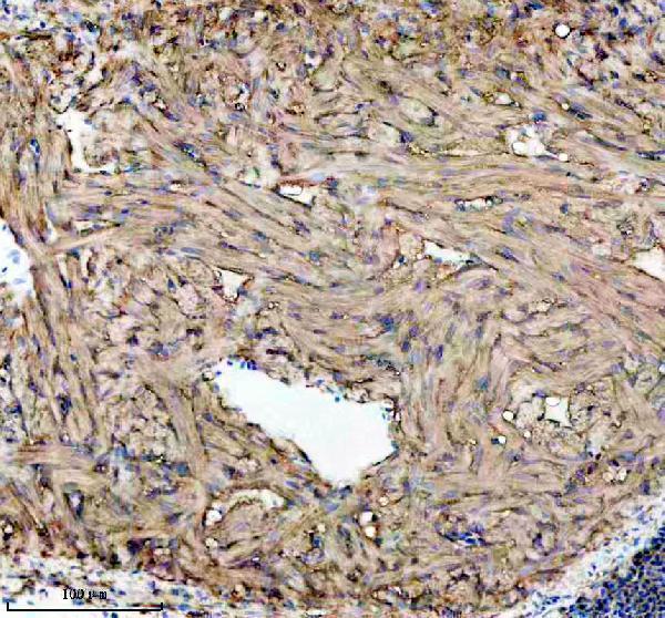 aza0a8m9prt8 glsa b primary antibodies ihc testing 2