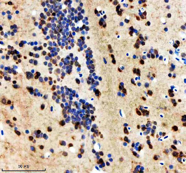  IHC analysis of HNRNPD using anti-HNRNPD antibody (AZA0A8M9QC46)