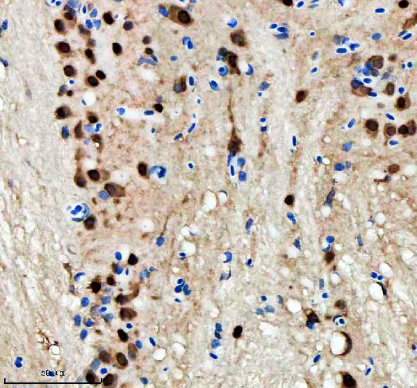 aza0a8m9qc46 hnrnpd primary antibodies ihc testing 4