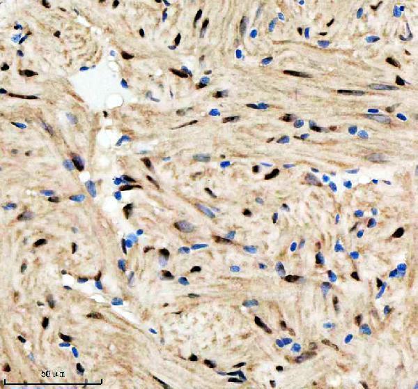 aza0a8m9qc46 hnrnpd primary antibodies ihc testing 5