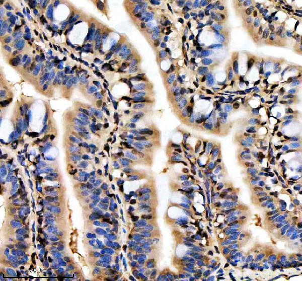 aza0a8m9qc46 hnrnpd primary antibodies ihc testing 6