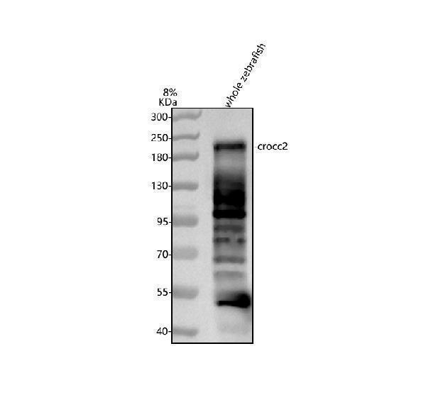 Western blot analysis of CROCC2 using anti-CROCC2 antibody (AZA0A8M9QG25)