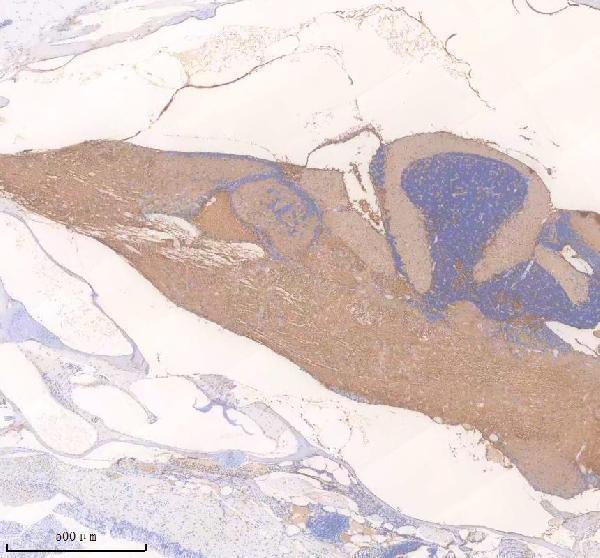 IHC analysis of NFKB1 using anti-NFKB1 antibody (AZA0A8M9QGX8)