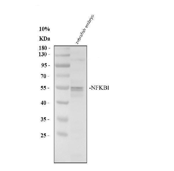 Western blot analysis of NFKB1 using anti-NFKB1 antibody (AZA0A8M9QGX8)