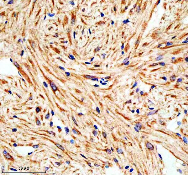  IHC analysis of LIMS1 using anti-LIMS1 antibody (AZA0A8M9QHP1)