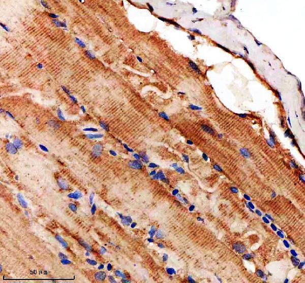  IHC analysis of LIMS1 using anti-LIMS1 antibody (AZA0A8M9QHP1)
