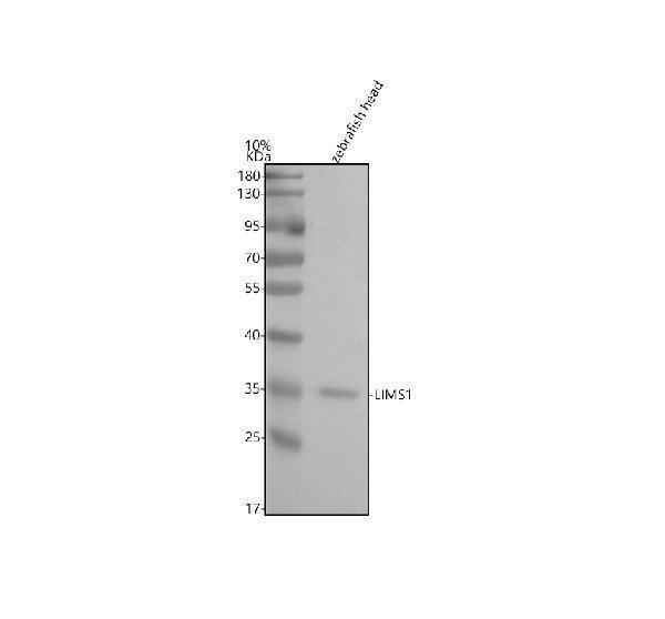  Western blot analysis of LIMS1 using anti-LIMS1 antibody (AZA0A8M9QHP1)