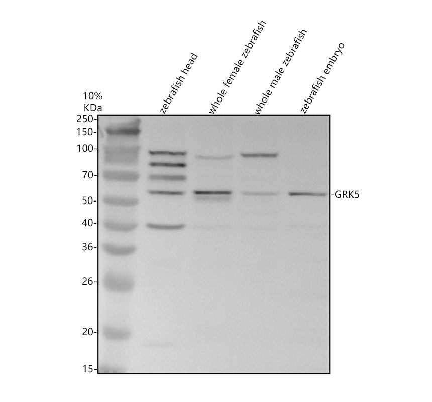 aza0a8m9qkr0 grk5 primary antibodies wb testing 1