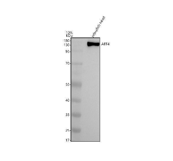  Western blot analysis of AFF4 using anti-AFF4 antibody (AZA0A8N7TEI3)
