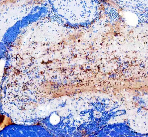 IHC analysis of MMP19 using anti-MMP19 antibody (AZA0AB32TZ88)