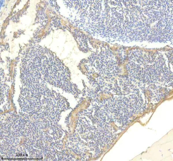 IHC analysis of TTN using anti-TTN antibody (AZA0AB32TZZ1)