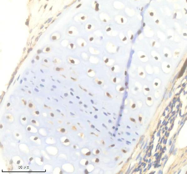 IHC analysis of TTN using anti-TTN antibody (AZA0AB32TZZ1)