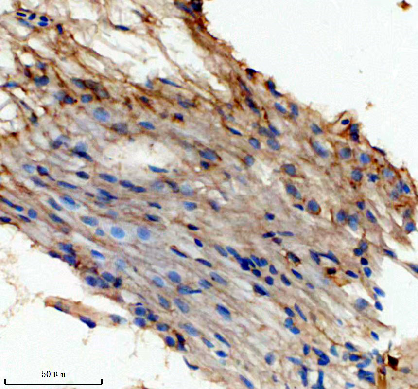aza0ac58h7z7 gpr101 primary antibodies ihc testing 1
