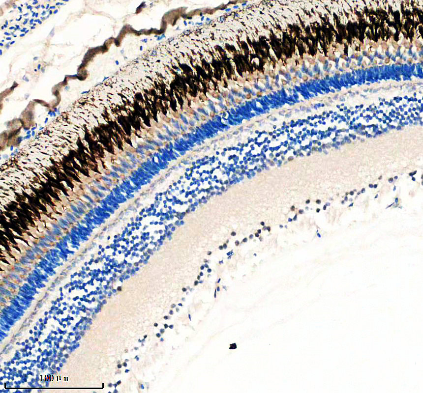aza0ac58ihw0 glis2a primary antibodies ihc testing 1
