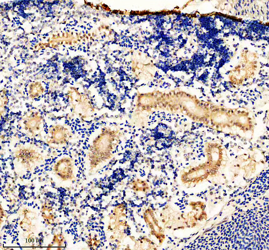 aza0ac58ihw0 glis2a primary antibodies ihc testing 2