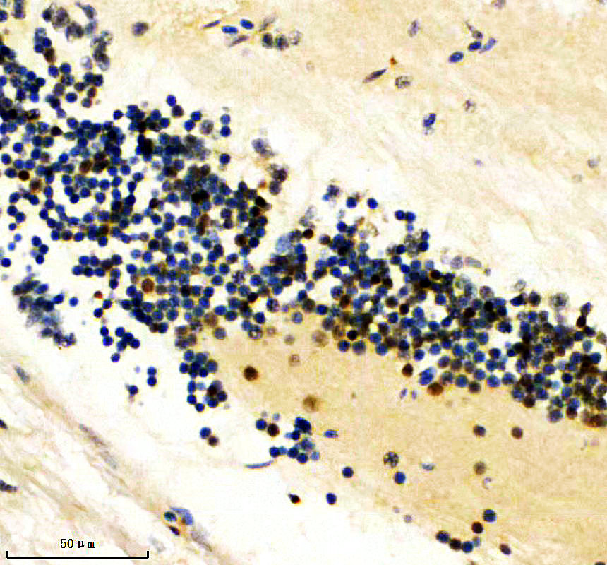 aza0ac58ihw0 glis2a primary antibodies ihc testing 3
