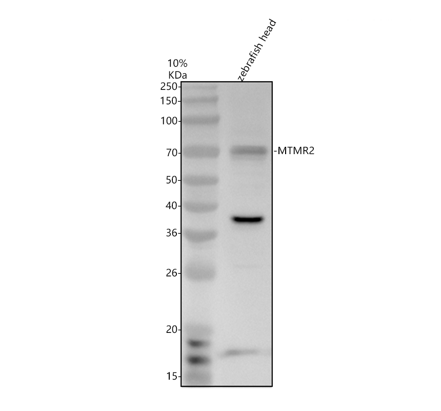 aza0jmk5 mtmr2 primary antibodies wb testing 1