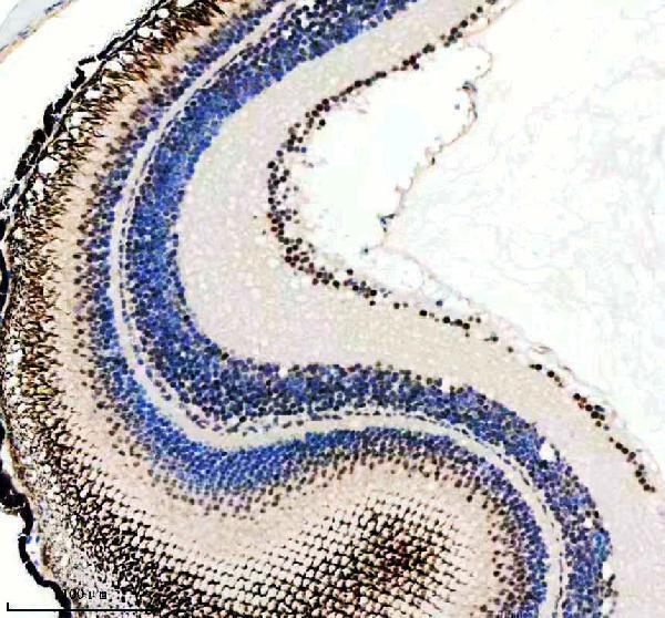  IHC analysis of CROP/LUC7L3 using anti-CROP/LUC7L3 antibody (AZA1L1N4)