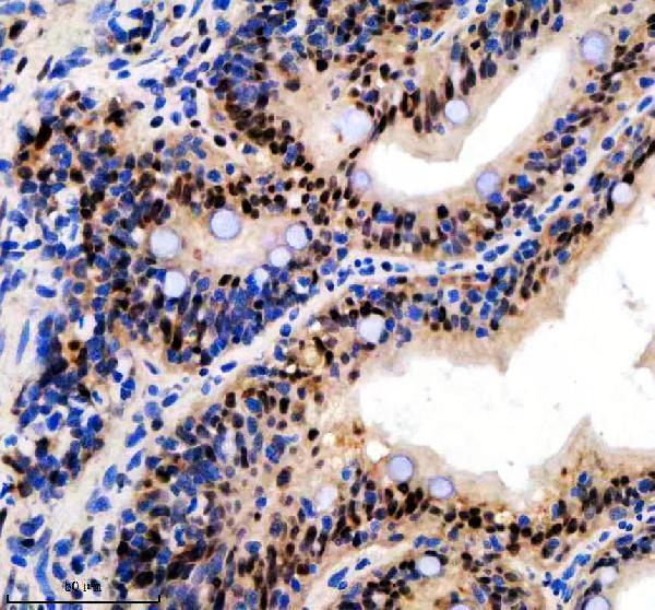  IHC analysis of CROP/LUC7L3 using anti-CROP/LUC7L3 antibody (AZA1L1N4)
