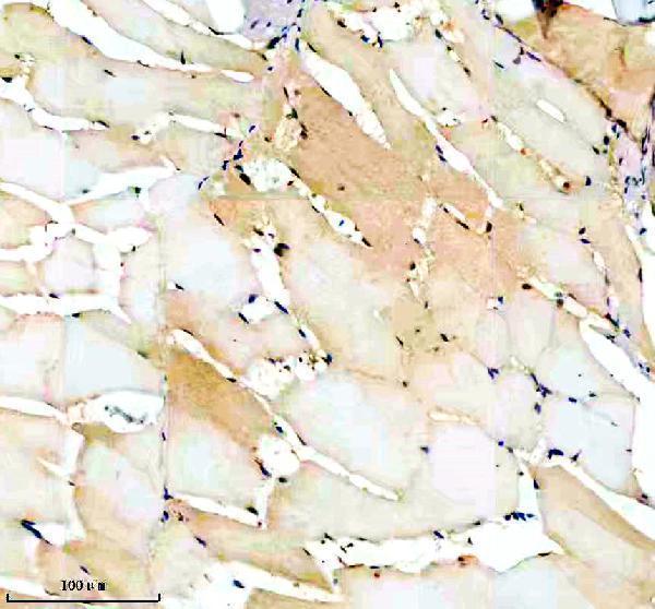 aza1l1n4 luc7l3 primary antibodies ihc testing 6