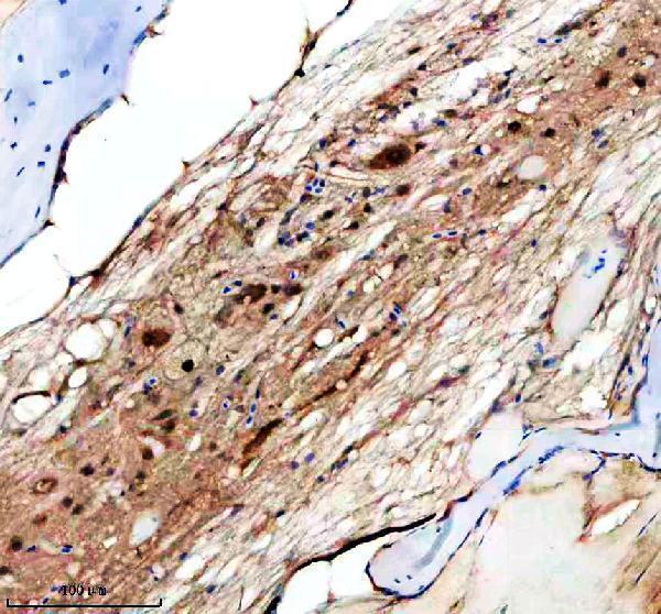 aza1l1p8 hs2st1a b primary antibodies ihc testing 1
