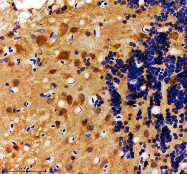 aza1l1p8 hs2st1a b primary antibodies ihc testing 2