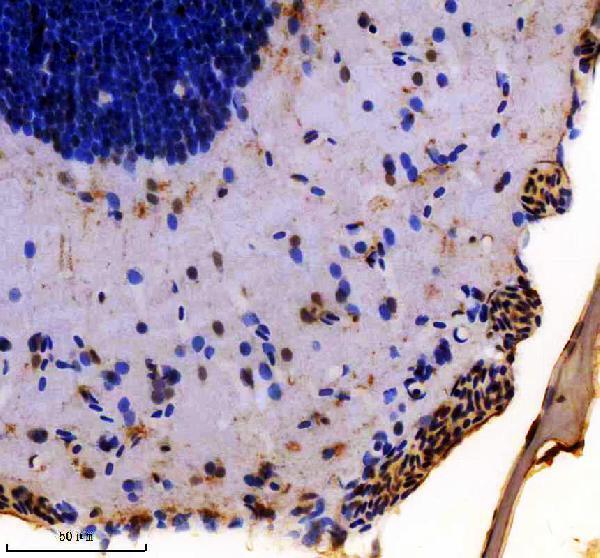 IHC analysis of VHL using anti-VHL antibody (AZA1L296)