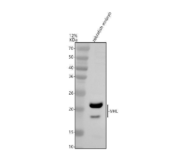 Western blot analysis of VHL using anti-VHL antibody (AZA1L296)