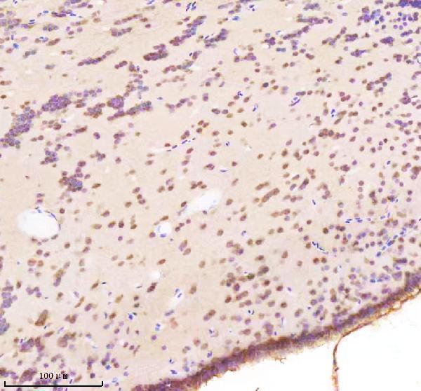  IHC analysis of BAP1 using anti-BAP1 antibody (AZA1L2G3)