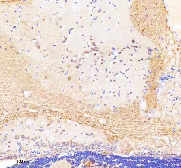  IHC analysis of BAP1 using anti-BAP1 antibody (AZA1L2G3)