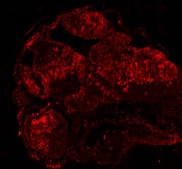 IF analysis of DGCR8 using anti-DGCR8 antibody (AZA2BEG3)