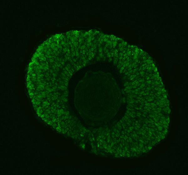 IF analysis of DGCR8 using anti-DGCR8 antibody (AZA2BEG3)
