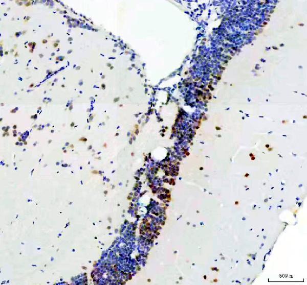 IHC analysis of DGCR8 using anti-DGCR8 antibody (AZA2BEG3)