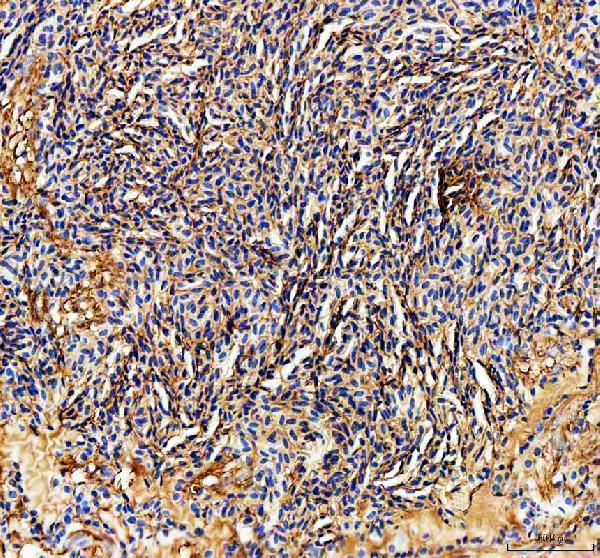 aza2bha3 ckma b primary antibodies ihc testing 2